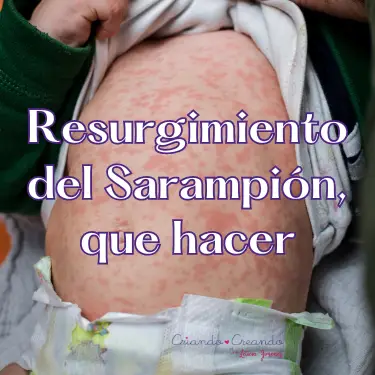 Resurgimineto del sarampion que hacer foto del abdomen de un bebé con sarampión